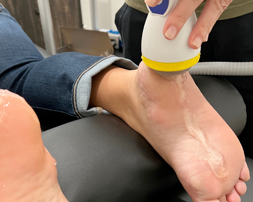How SoftWave Therapy is a Beacon of Hope for Plantar Fasciitis Sufferers